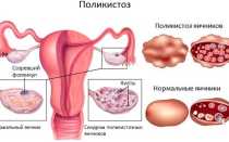 Фазы менструального цикла: схема по дням