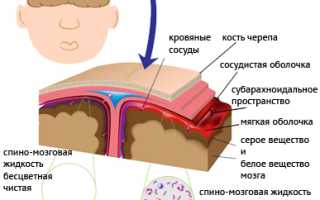 Менингит: негативные последствия и методы их минимизации