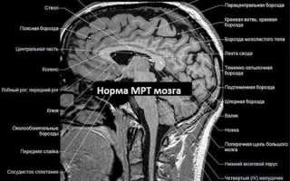 Почему появляется боль в области затылка с левой стороны