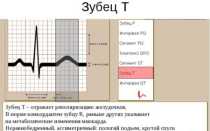 Что показывает зубец т на экг