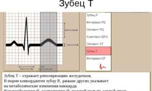 Что показывает зубец т на экг