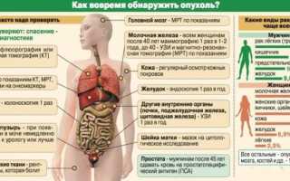 Женские онкологические заболевания: рак в гинекологии