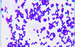 Staphylococcus haemolyticus норма у мужчин